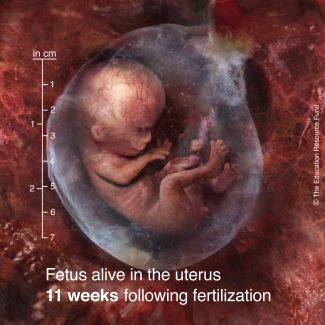 Fetus alive in the uterus 11 weeks following fertilization